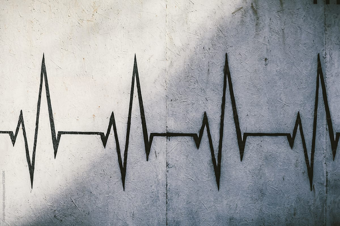 Heart Rate Graffiti" by Stocksy Contributor "Giorgio Magini" - Stocksy