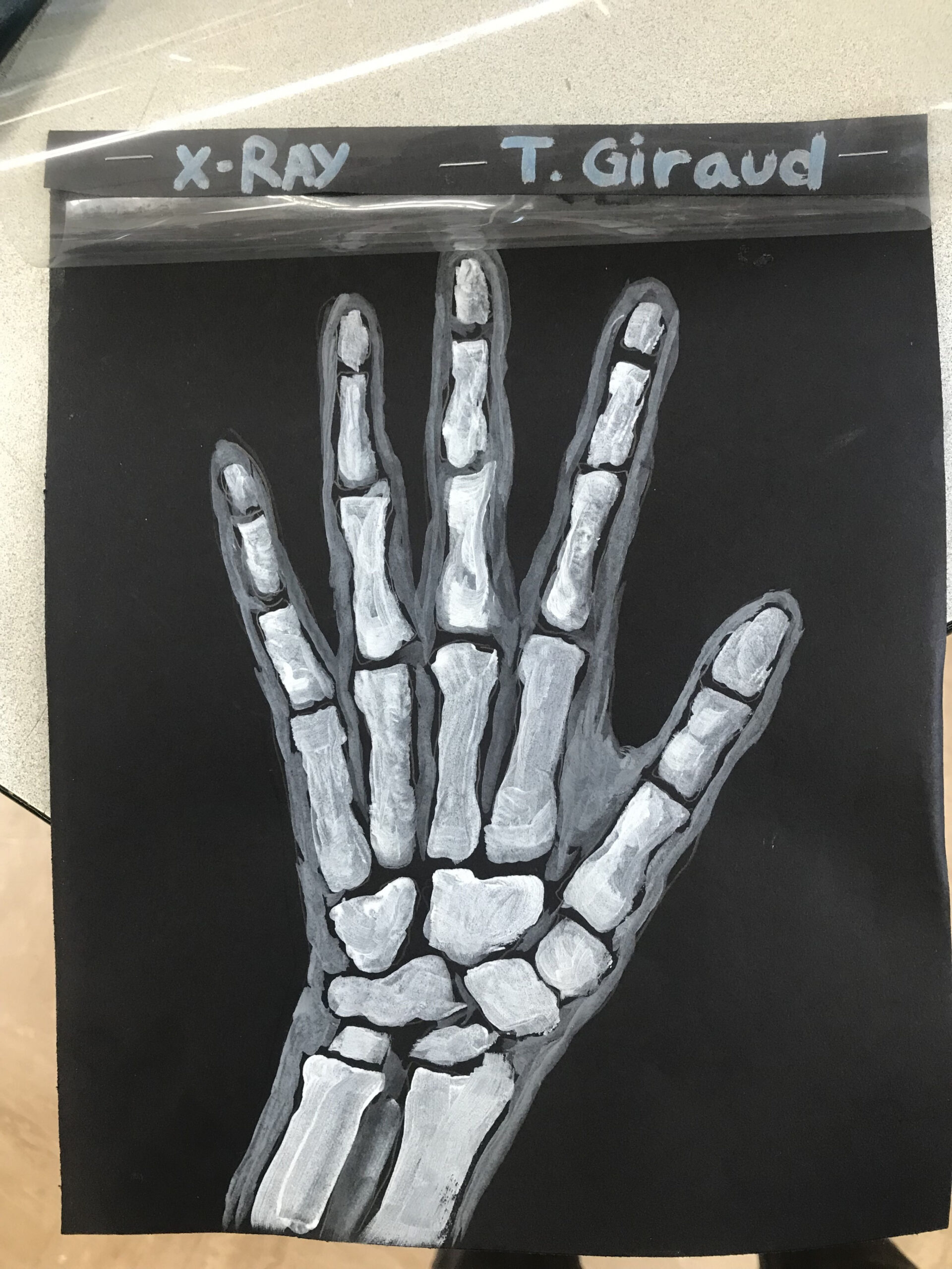 X-Ray of hand  Skeleton art projects, Elementary art projects